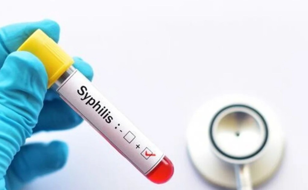 Crisis sanitaria: Los casos de sífilis se disparan un 20.5% en Argentina y encienden el&nbsp;alerta